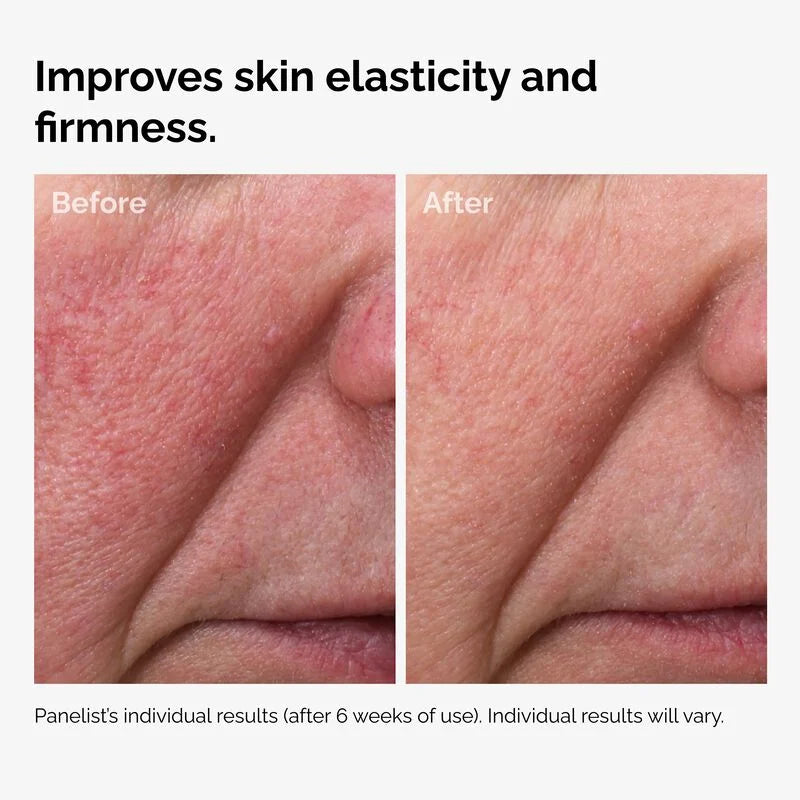 100% Fermented Rose Hip Seed Oil - skin care and cosmetics