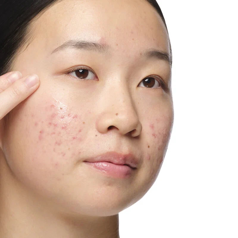 Aloe 2% + NAG 2% Solution - skin care and cosmetics