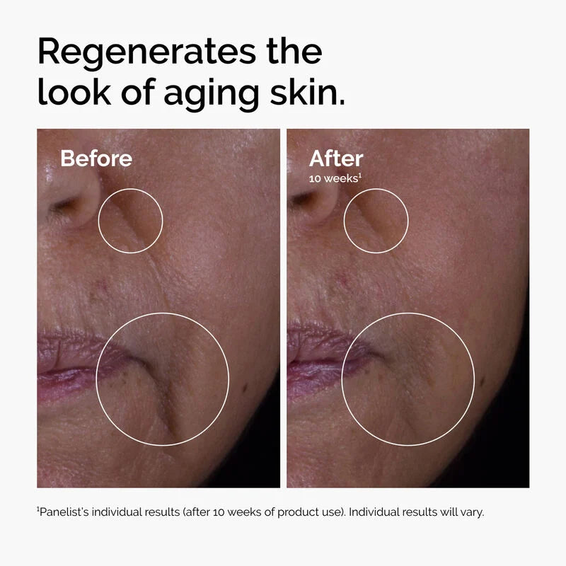 GF 15% Solution - skin care and cosmetics