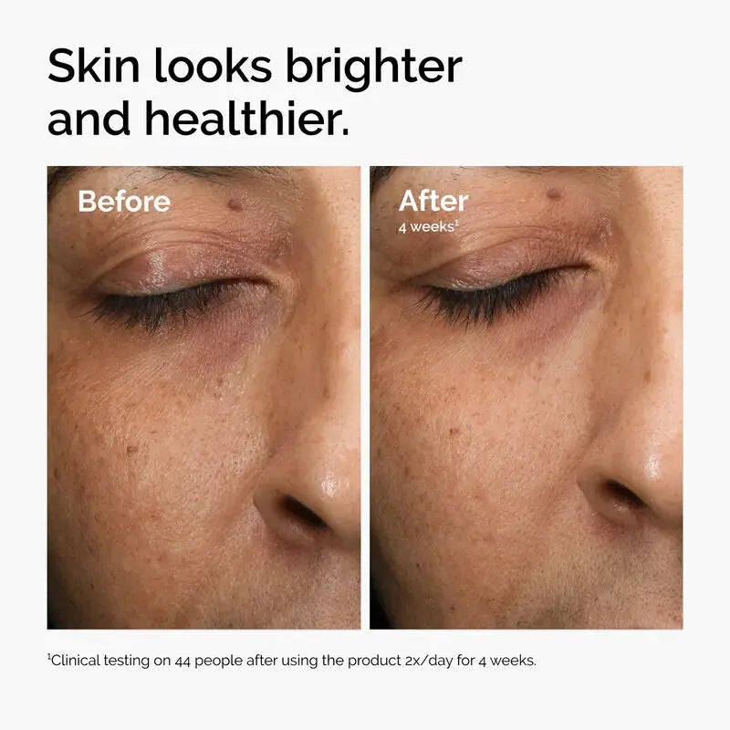 Multi-Antioxidant Radiance Serum - skin care and cosmetics