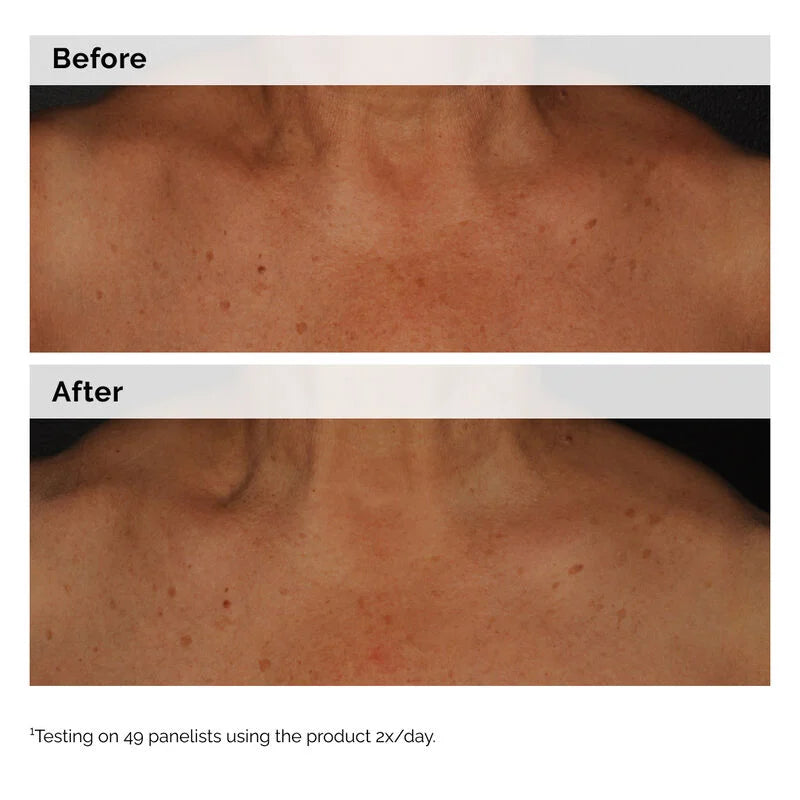 Niacinamide 5% Face and Body Emulsion - skin care and cosmetics