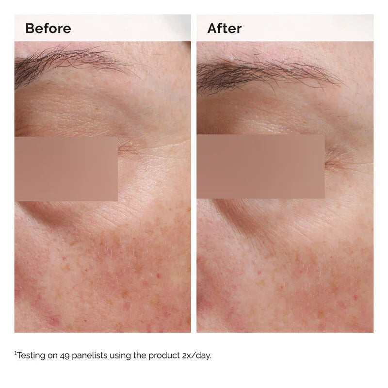 Niacinamide 5% Face and Body Emulsion - skin care and cosmetics