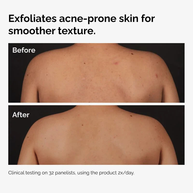 Salicylic Acid 0.5% Body Serum - skin care and cosmetics
