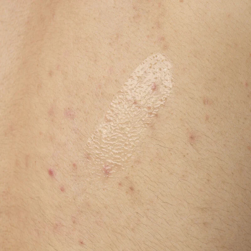 Salicylic Acid 0.5% Body Serum - skin care and cosmetics