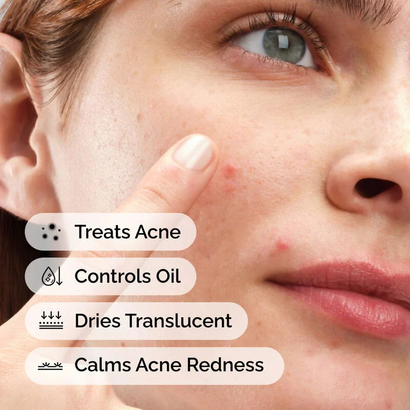 Sulfur 10% Powder-to-Cream Concentrate - skin care and cosmetics