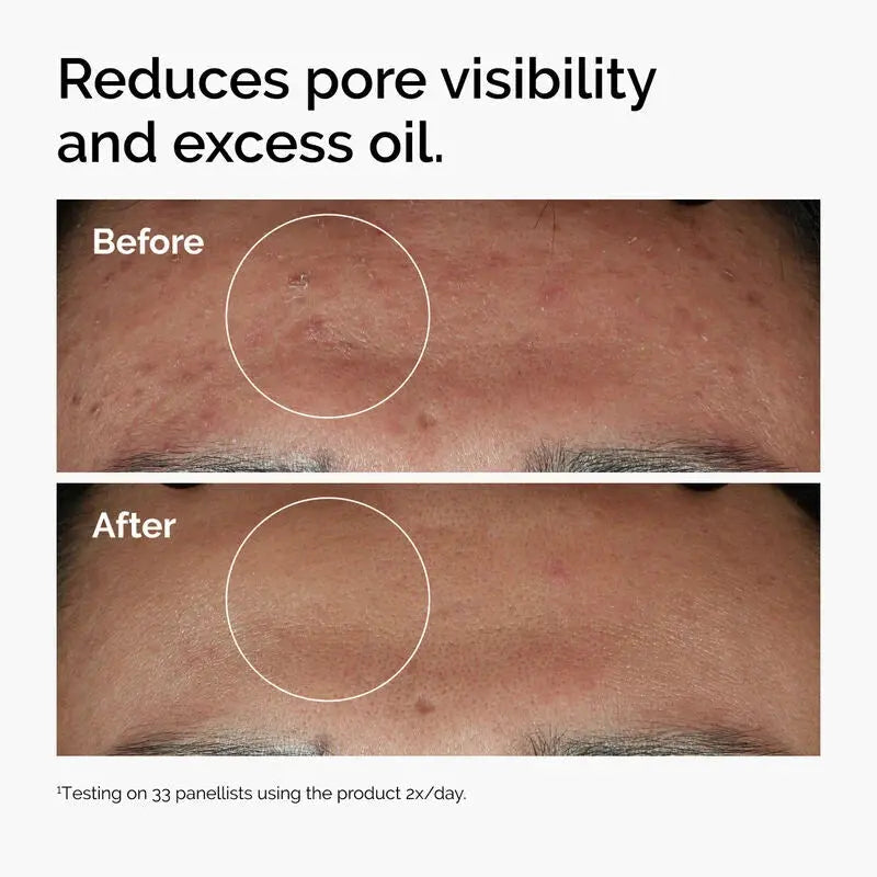 Niacinamide 10% + Zinc 1% - skin care and cosmetics