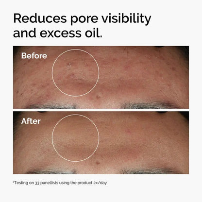 Niacinamide 10% + Zinc 1% - skin care and cosmetics