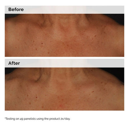 Niacinamide 5% Face and Body Emulsion - skin care and cosmetics