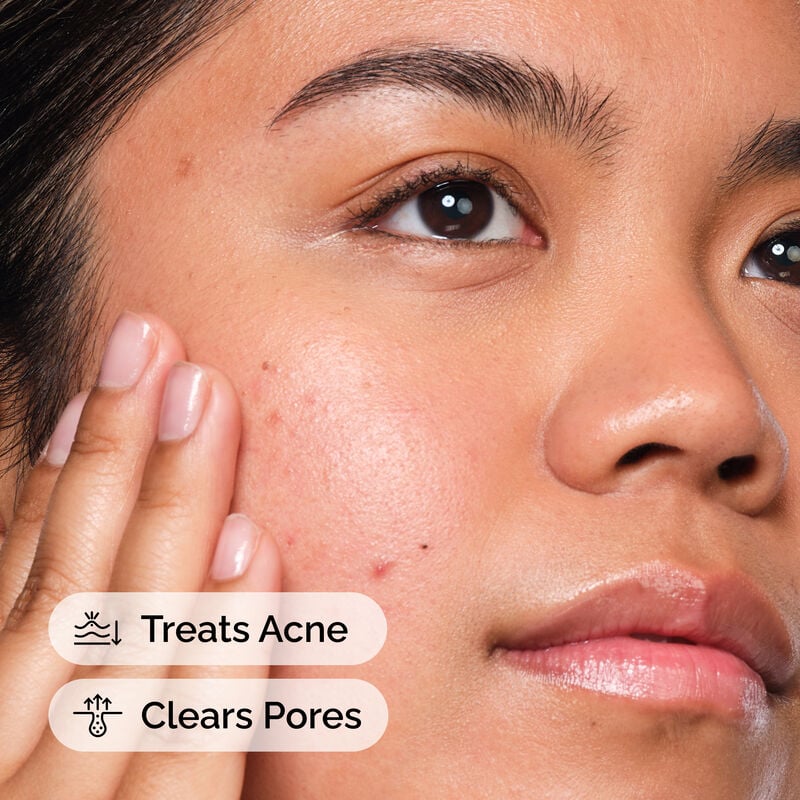 Salicylic Acid 2% Solution - skin care and cosmetics
